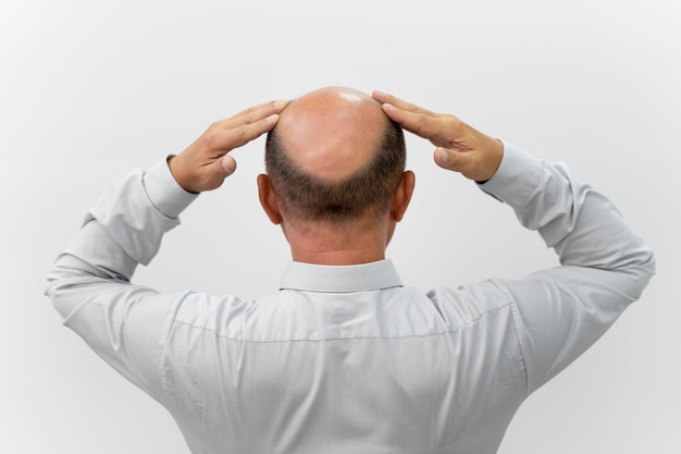 Is hair transplant good for men?