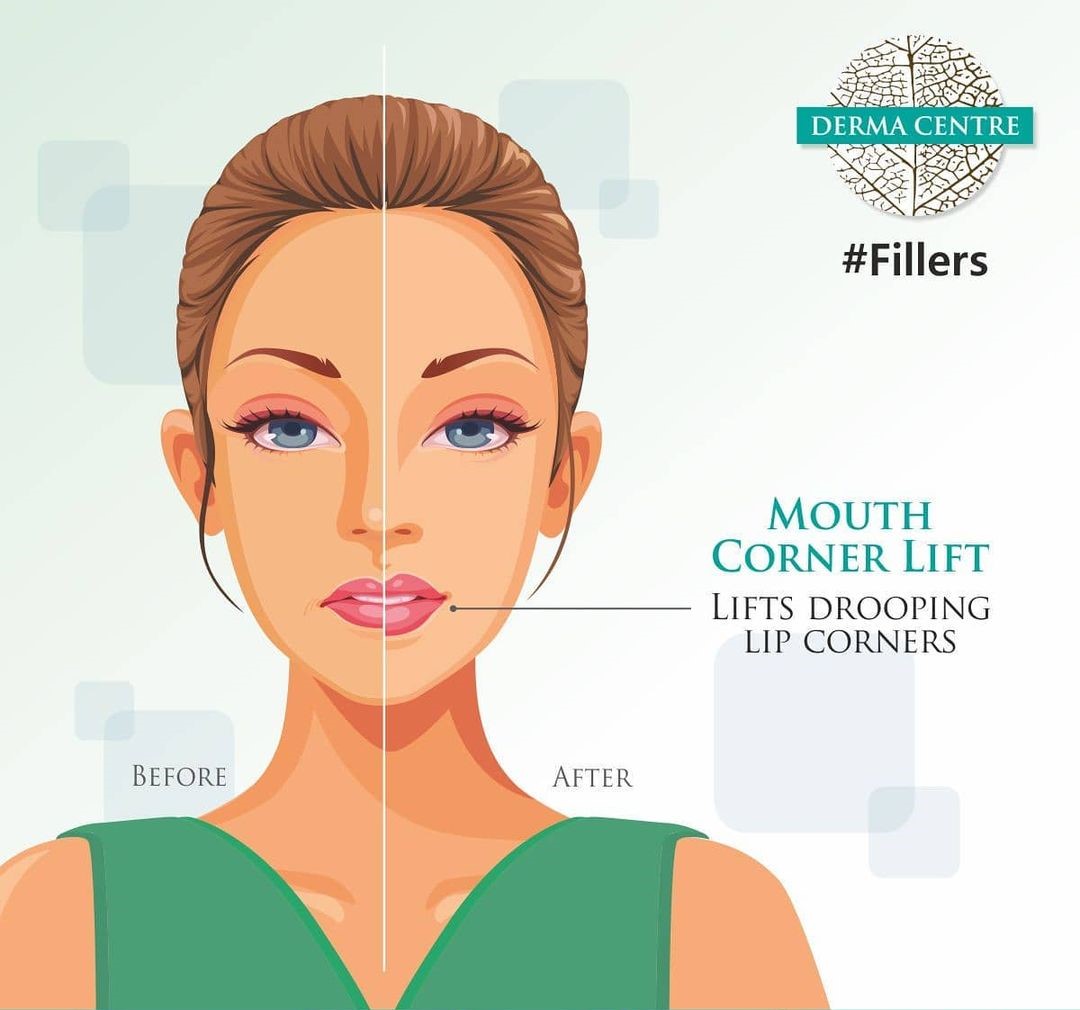 Dermatologist Specialist vs. General Dermatologist: What&rsquo;s the Difference?
