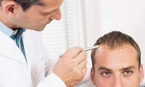 Could I go bald again after a hair transplant?