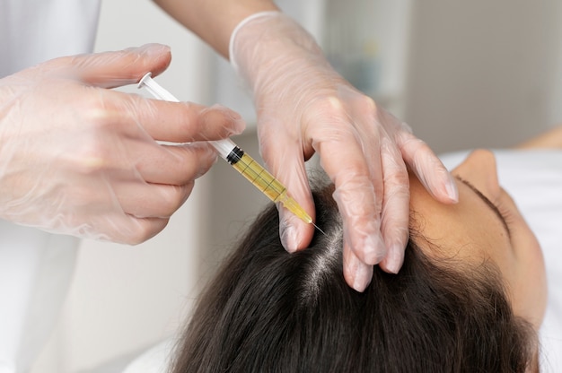 Boosting Hair Growth with PRP Hair Treatment 