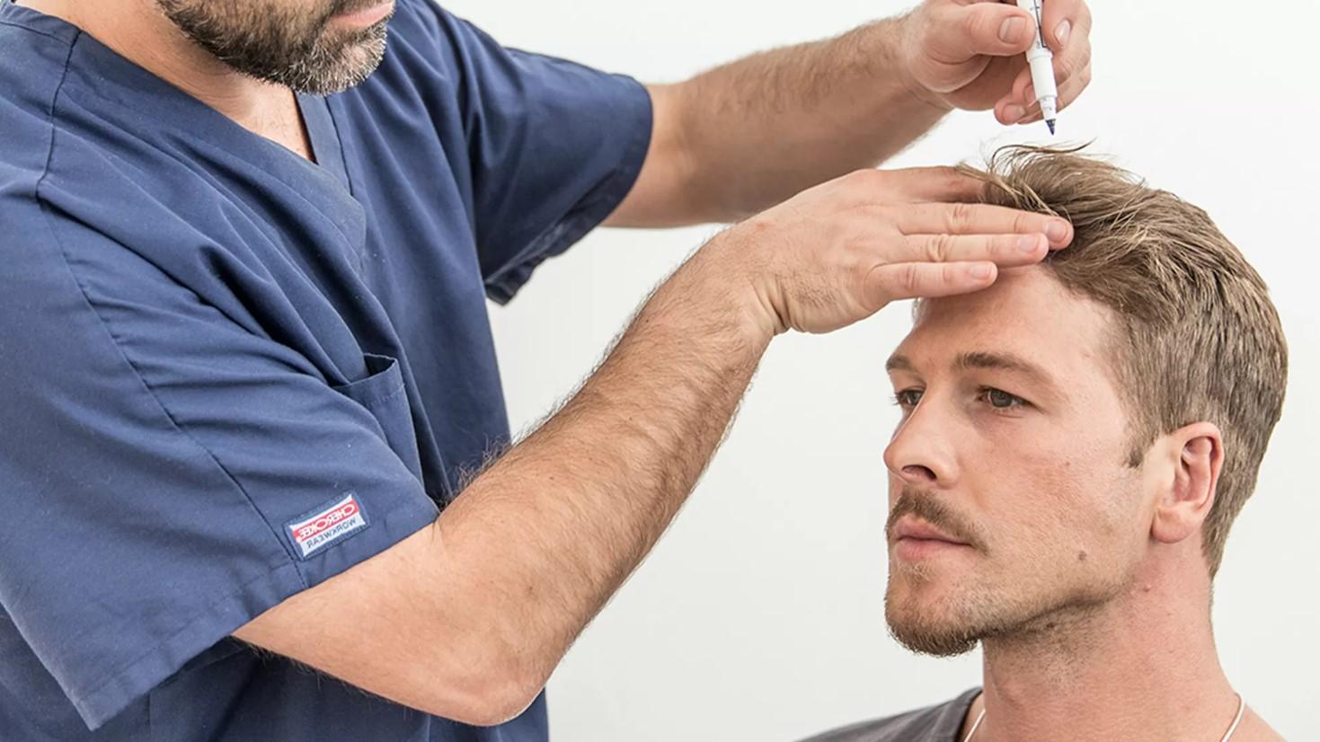 Why Riyadh is a Leading Destination for Hair Transplants