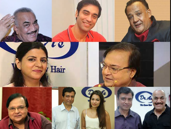 Best Hair Transplant in Delhi, Fuse Hair