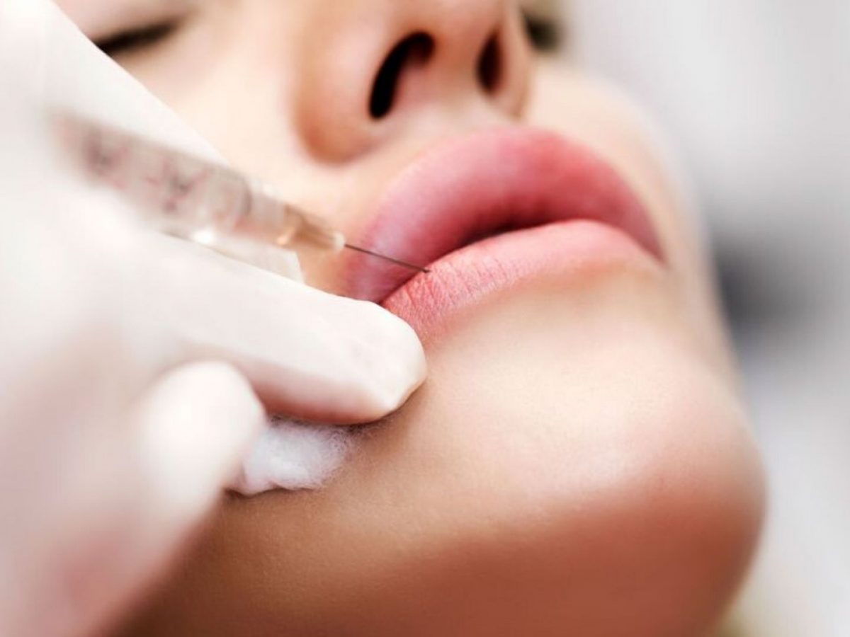 Transform Your Lips with Botox Lip Flip in Dubai
