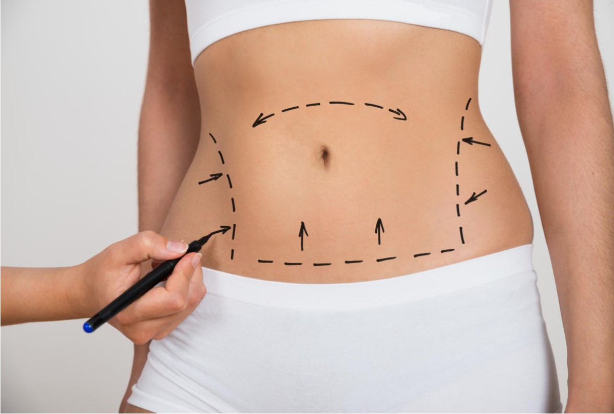 Non-surgical fat reduction treatments Riyadh&rsquo;s top choices