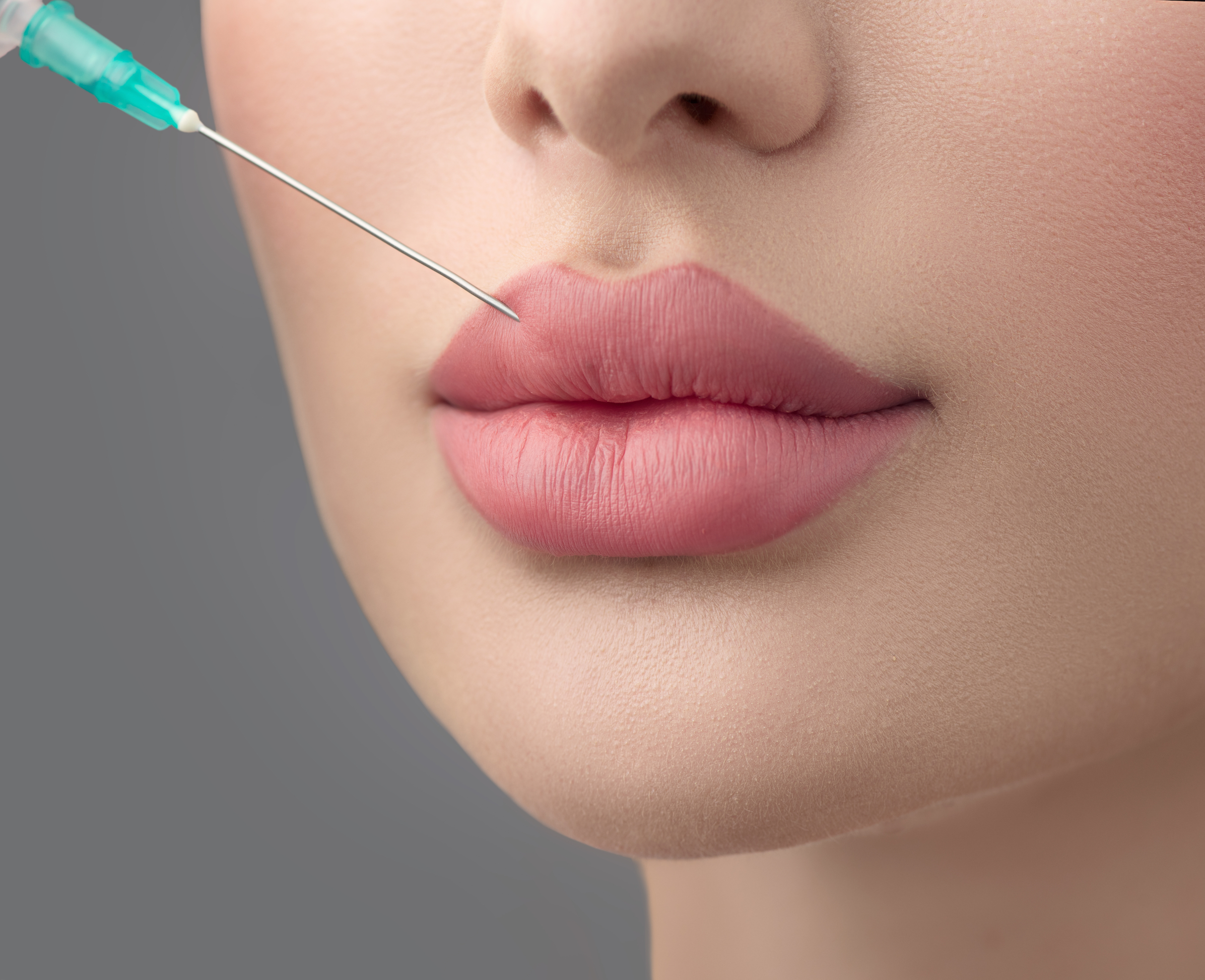 How Botox Lip Flip in Dubai Transforms Your Lips