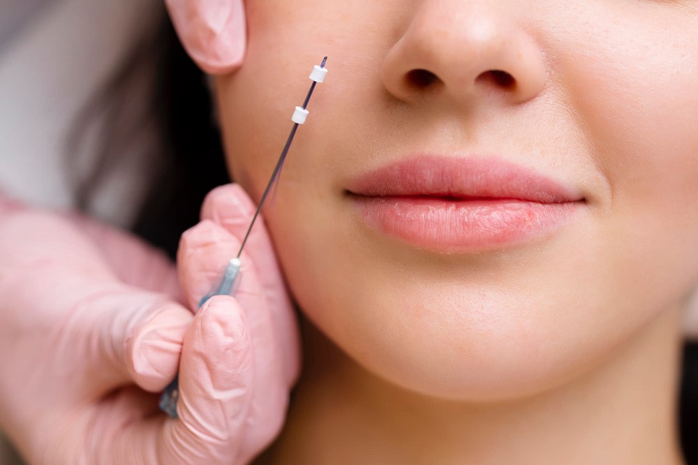 Thread Lift in Islamabad: Glamorous Clinic&rsquo;s Expertise Explained