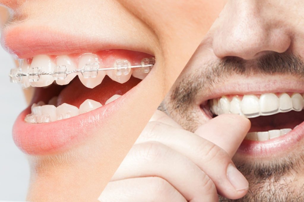 Find the Best Newark DE Dentist for Your Complete Dental Care Needs 