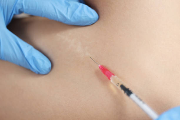 The Elite Choice for Fat-Dissolving Injections in Dubai