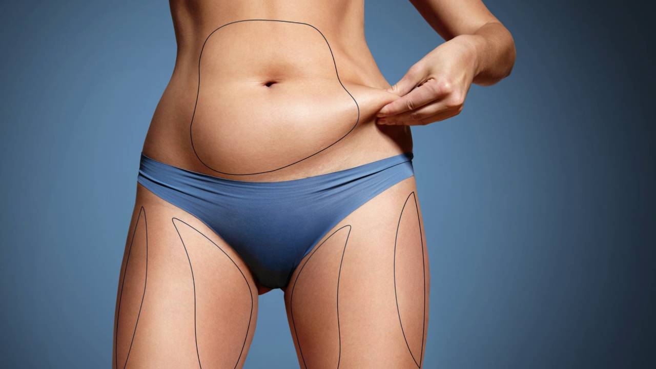 What Is The Safest Fat Removal Procedure?