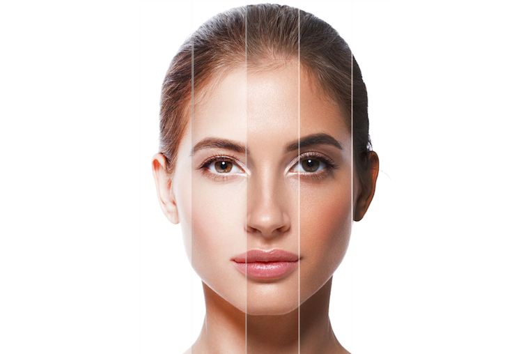 Cold Peel for Minimal Downtime
