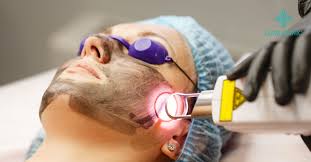 Is Pico Laser Treatment Right for Your Skin Needs?