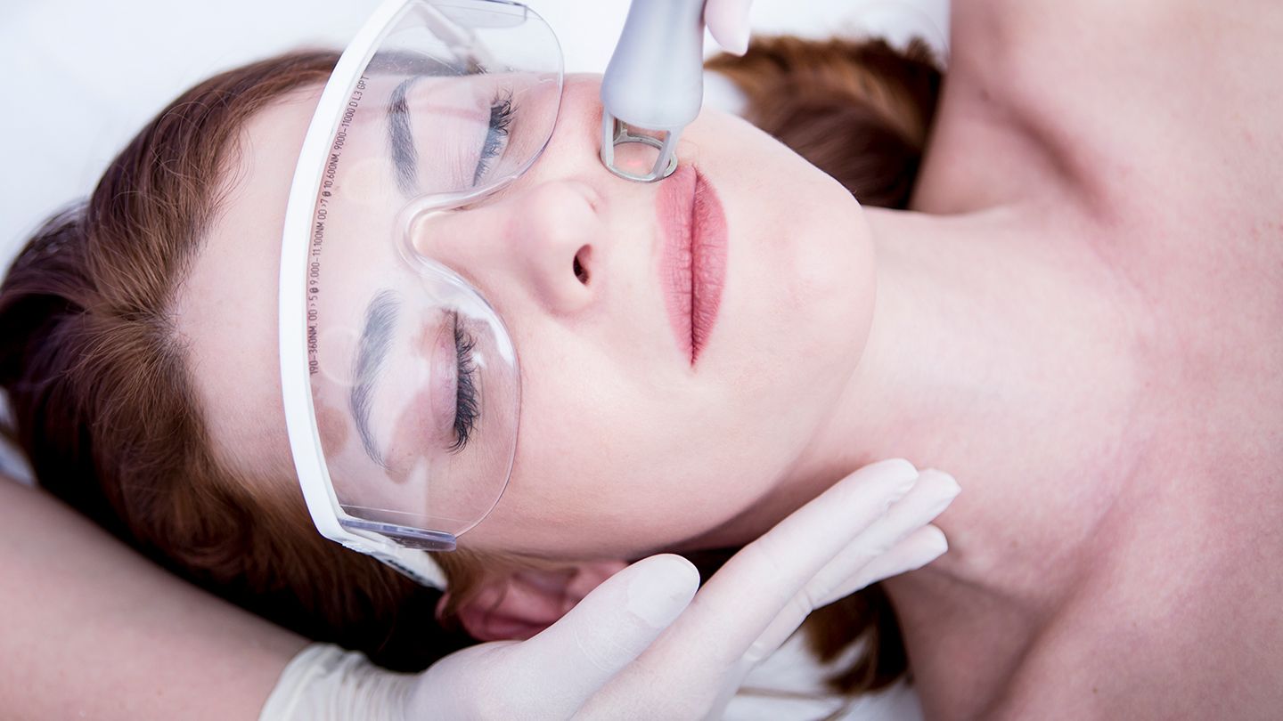 How Laser Works for Dark Circles Treatment?