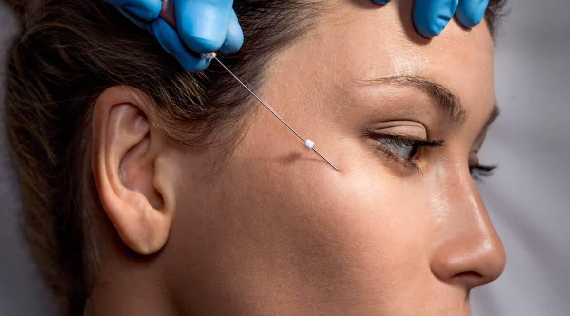 Is Thread Lift Treatment Better Than Fillers?