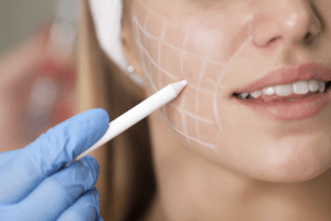 Smooth, Sculpt, and Shine: Everything You Need to Know About Fillers in Dubai