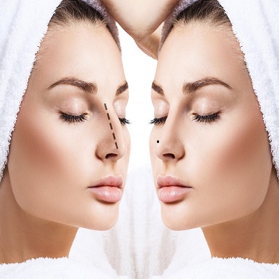 Meet Islamabad&rsquo;s Leading Rhinoplasty Experts