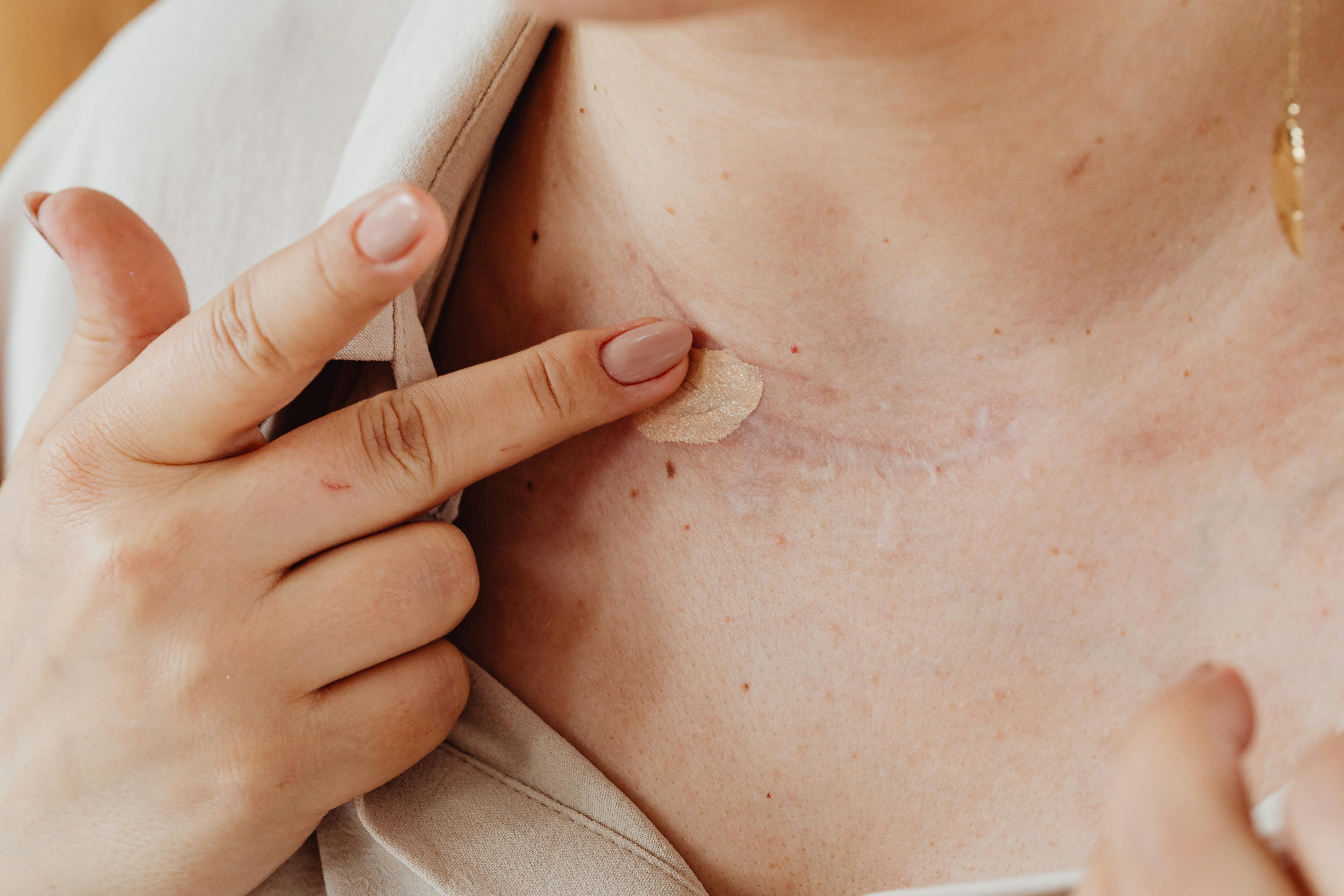Reveal Your Confidence with Brazilian Scar Camouflage near Sunriver