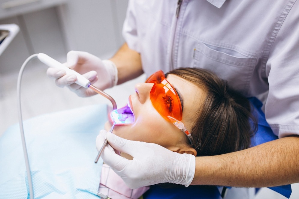 The Ultimate Guide to Teeth Whitening: What You Need to Know