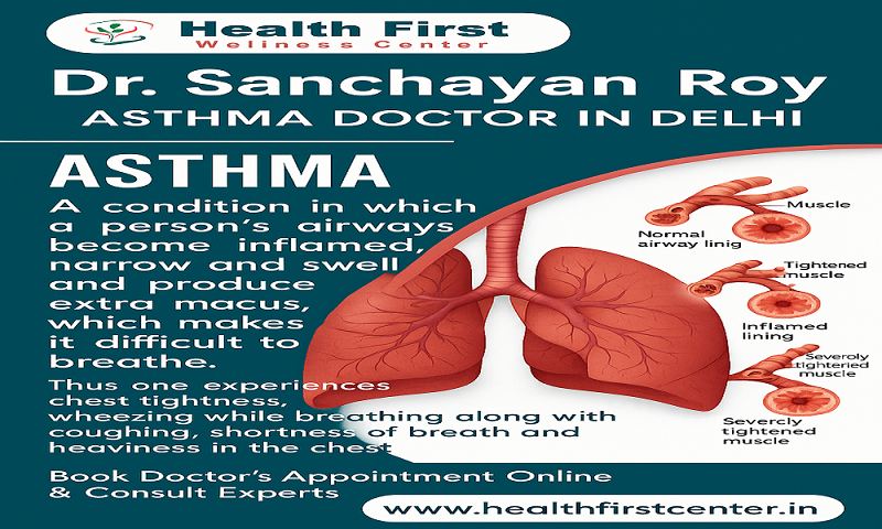 Reclaim Your Breath &ndash; Asthma Specialist Doctor Near Me: Dr. Sanchayan Roy