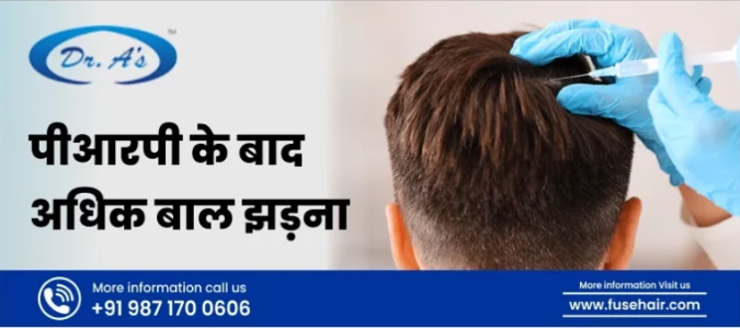 PRP ke Baad Baal Jhadna: Karan, Ilaaj aur Aftercare Checklist (Delhi Patients Guide)
