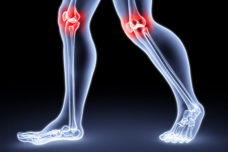Understanding Causes of Joint Inflammation and Practical Management Strategies