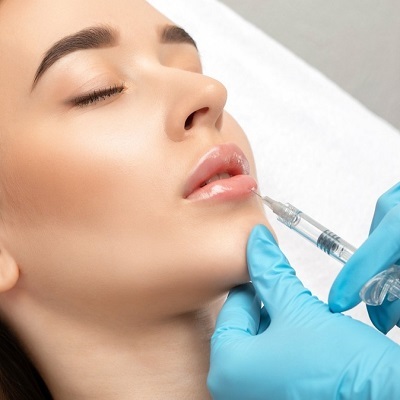 Lip Augmentation for Teens: Safe Options, Risks, and a Practical Checklist