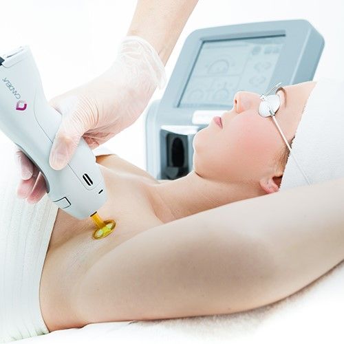Expert Laser Hair Removal in Dubai: What to Expect