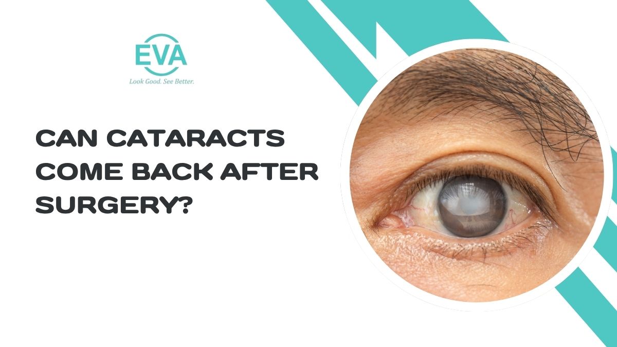 Can Cataracts Come Back After Surgery? Everything You Should Know