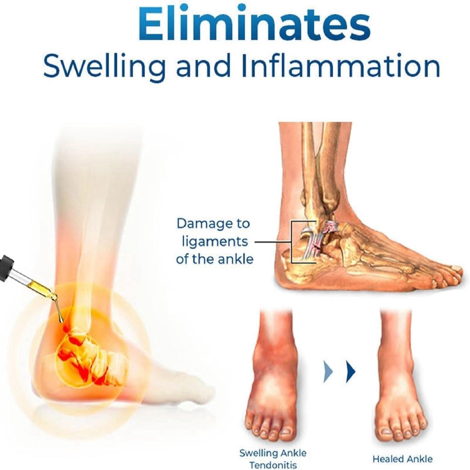 Swelling & Inflammation Treatment in Hoshiarpur: Causes, Symptoms & Best Treatment Options