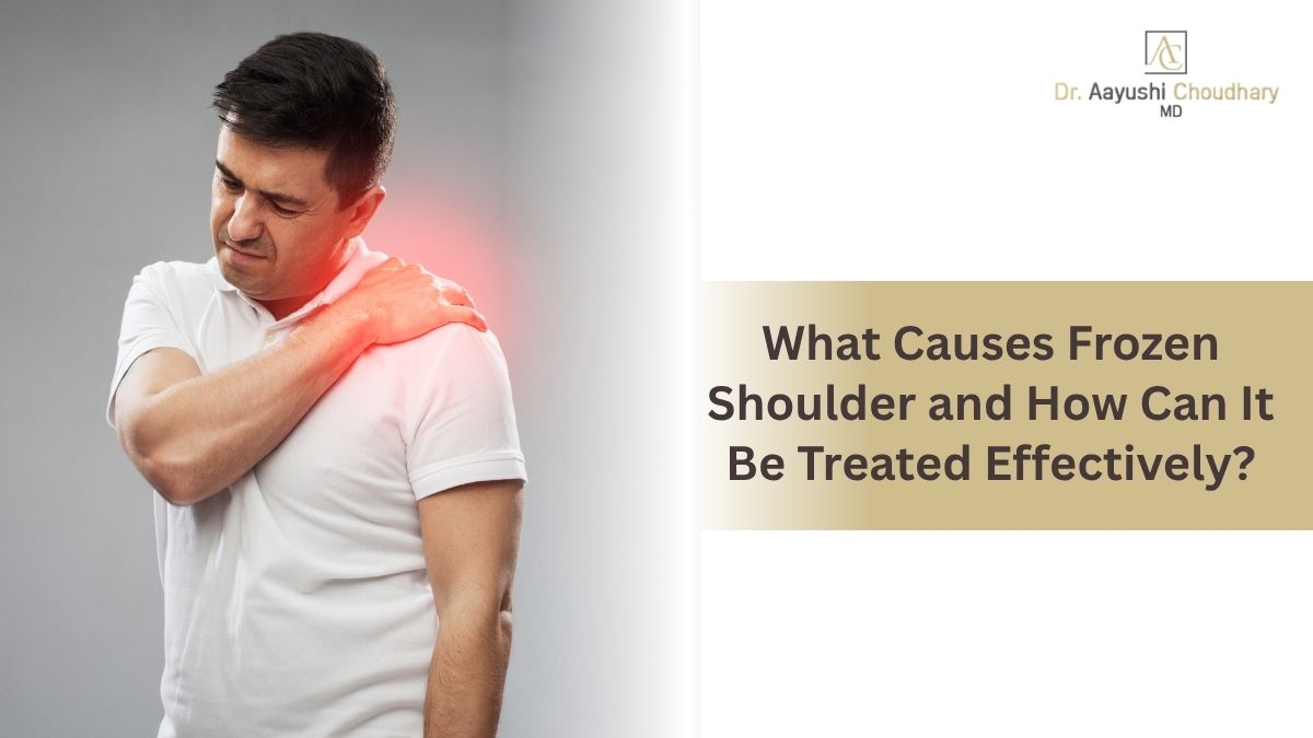 What Causes Frozen Shoulder and How Can It Be Treated Effectively?