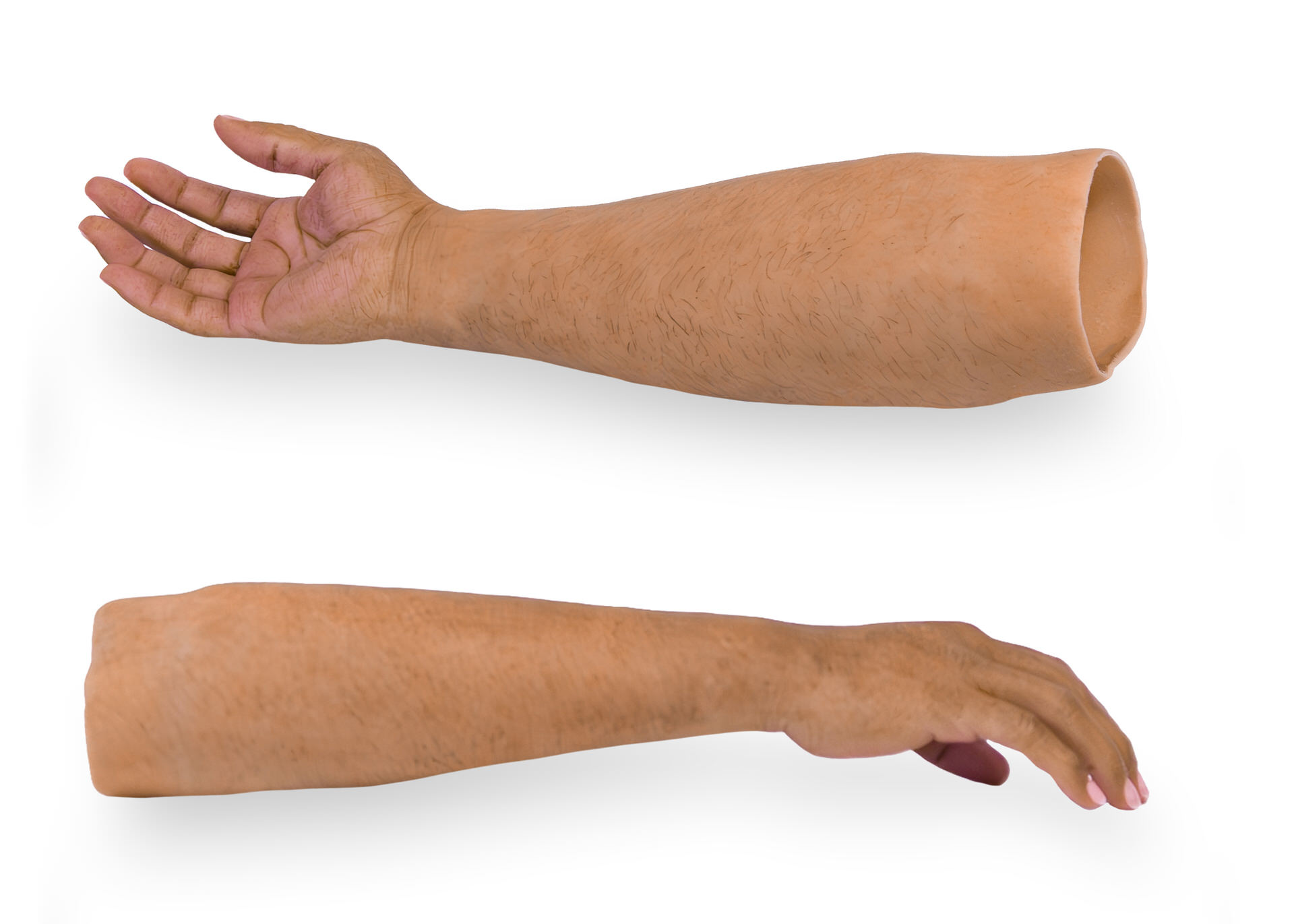 What Should You Know Before Choosing Custom Hand Prosthetics After a Hand Amputation?