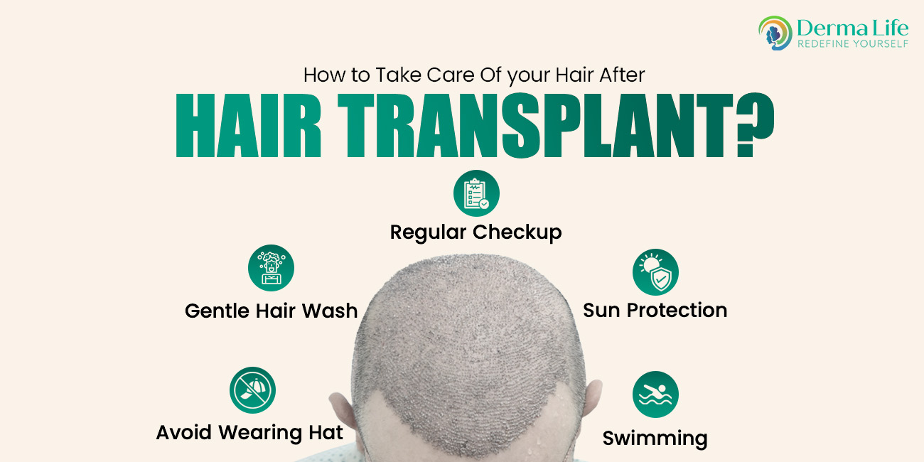 Hair Transplant vs Hair Loss Treatments: Which Is the Right Solution for You?