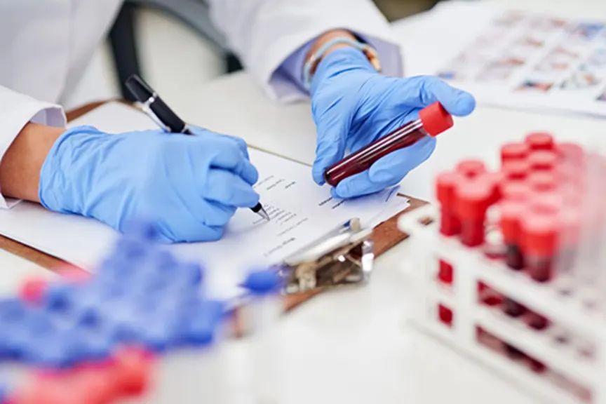 How Blood Tests Help Detect Serious Health Conditions Early
