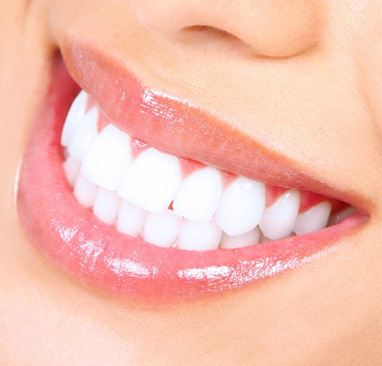 Teeth Whitening in Gurgaon: Cost, Procedure, and Expected Results