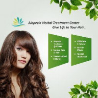alopecia
