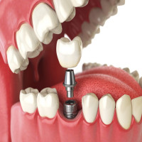 Dental Clinic  in dubai