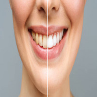 SunnyView Dental